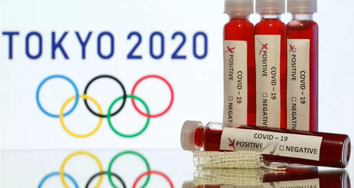 国际奥委会：东京奥运会的举行不取决于是否研发出抗新冠病毒疫苗
